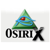 OsiriX MD 14/オザイリクス